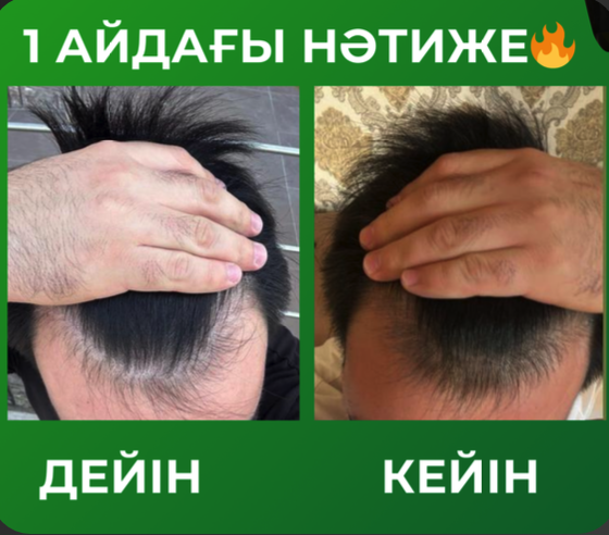 Фото до и после 1