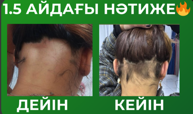 Фото до и после 2