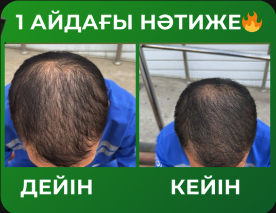 Фото до и после 3