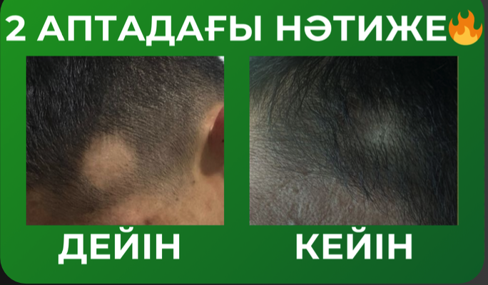 Фото до и после 4