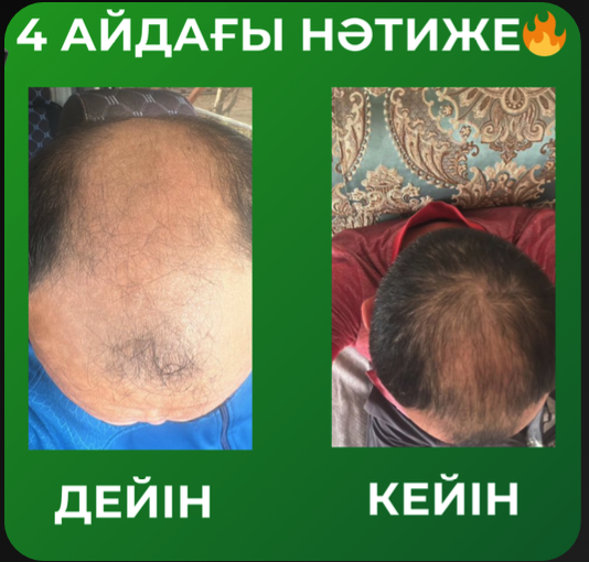 Фото до и после 5