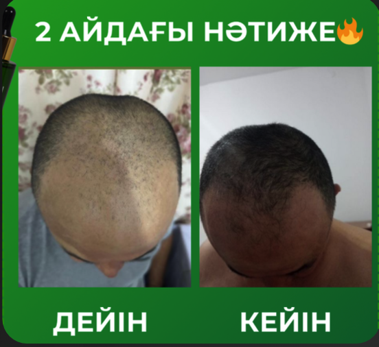 Фото до и после 5